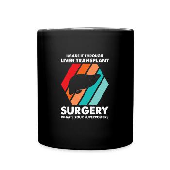 Lebertransplantation Chirurgie Lebertransplantatio - Tasse einfarbig - Schwarz - Vorne