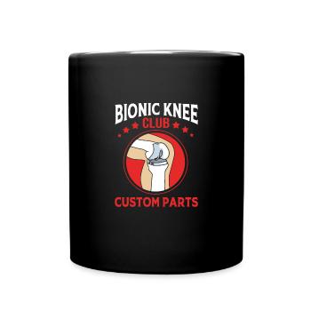 Knie Operation - Tasse einfarbig - Schwarz - Vorne
