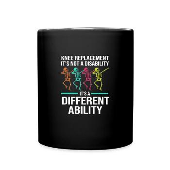 Knie Operation - Tasse einfarbig - Schwarz - Vorne
