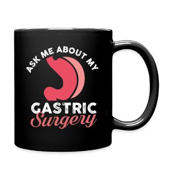 Ask me about my gastric surgery - Tasse einfarbig - Schwarz - Rechts