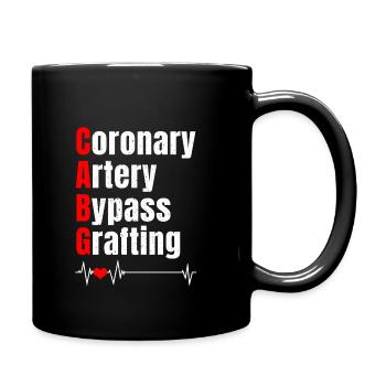 Bypass-Operation - Tasse einfarbig - Schwarz - Rechts