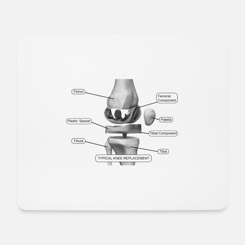 Kniekomponenten - Mousepad (Querformat) - Weiß