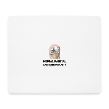 Medial Unicompartmental Knee Arthroplasty - Mouse Pad (horizontal) - white - Front