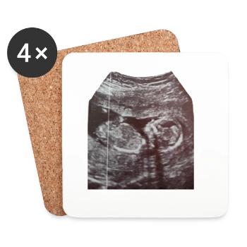 Chargement de bébés... Soyez patient ! Ultrason - Dessous de verre (lot de 4) - blanc - Devant