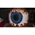 Radymatrix